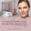 6 Large Laser Hair Removal Sessions